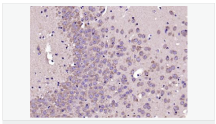 60595355b65ff.png image.png