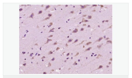 6059975ea03d0.png image.png