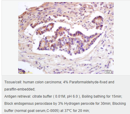 6061491a9db38.png image.png