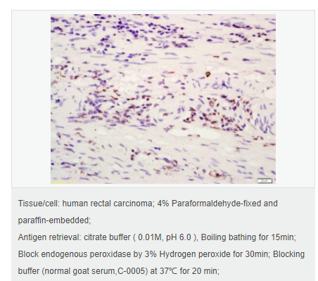 6076440e2cfc5.png image.png