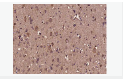 6076484c2e34c.png image.png